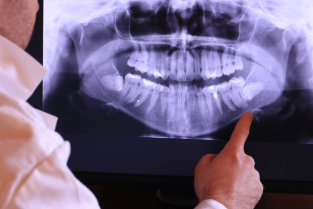Best Emergency Gum Treatment in Washington Park, IL